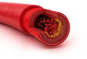cholesterol