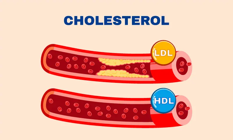 hdl cholesterol