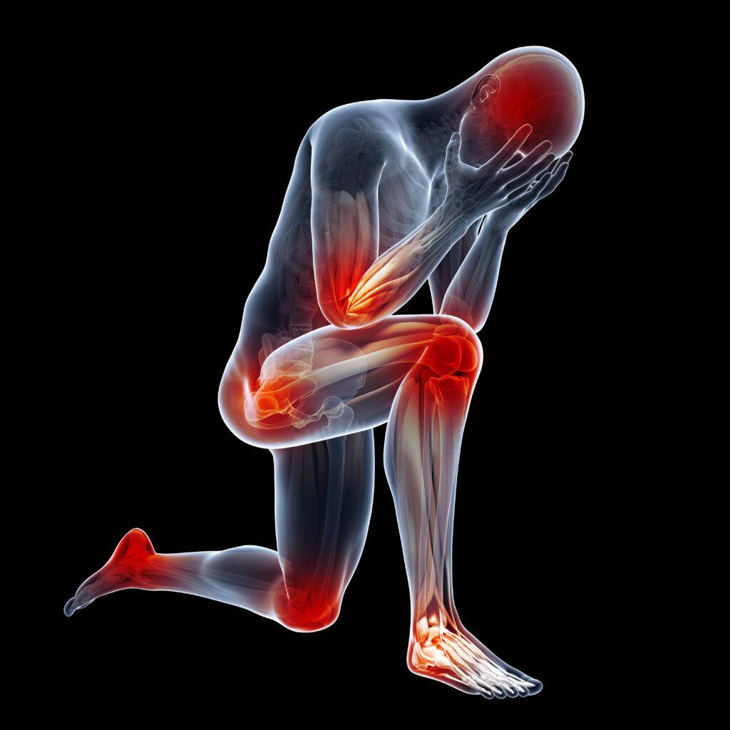 pain and inflammation