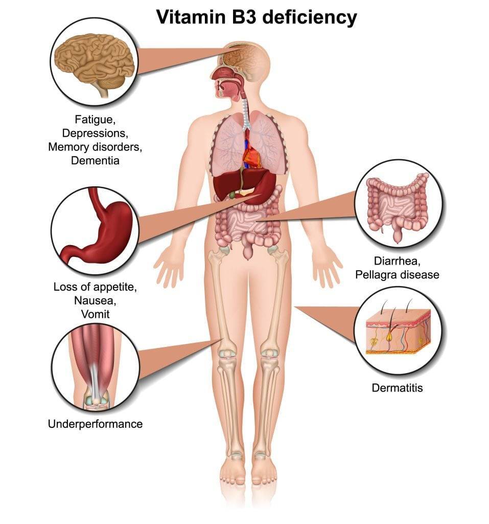 Vitamin B3