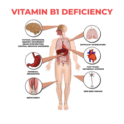 vitamin b1