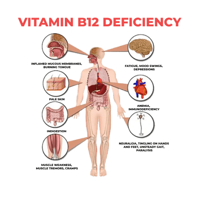 Vitamin B12