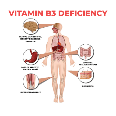 Vitamin B3