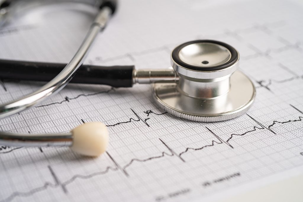 Arrhythmia